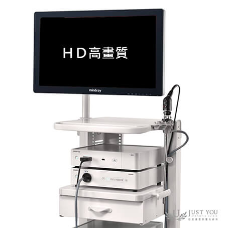 特色2-全程使用HD高畫質內視鏡