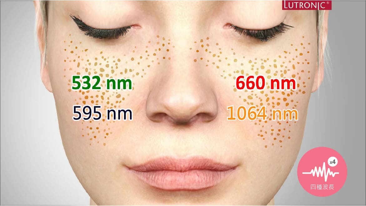 4D皮秒雷射四種波長可以治療到不同深度的肌膚